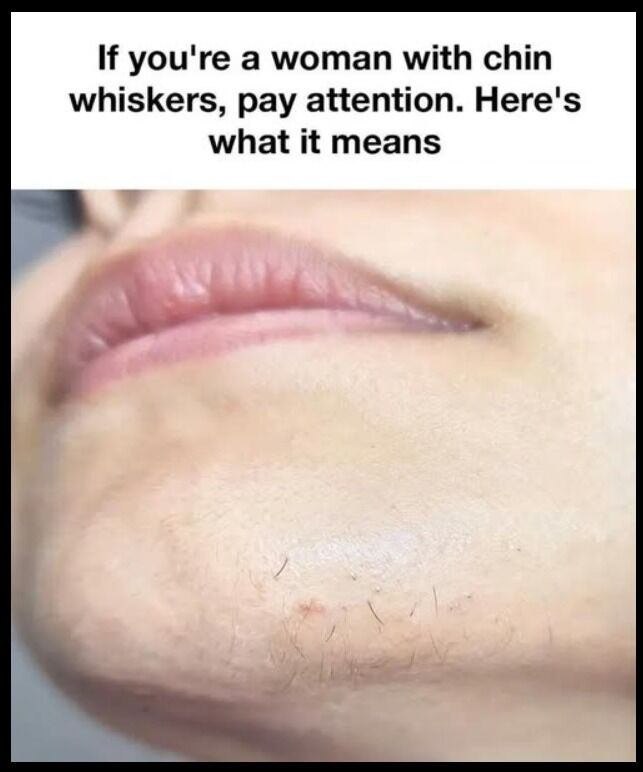 499478067_122116162802861640_747532082378679919_n