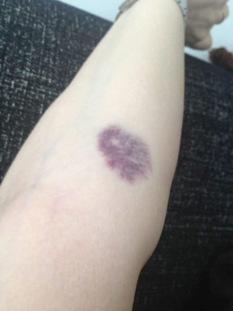 522624248_122173759592557643_8178684216139849022_n